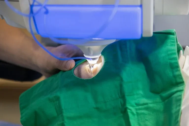 스마일라식 잘하는 병원, 수술건수를 확인해보세요!