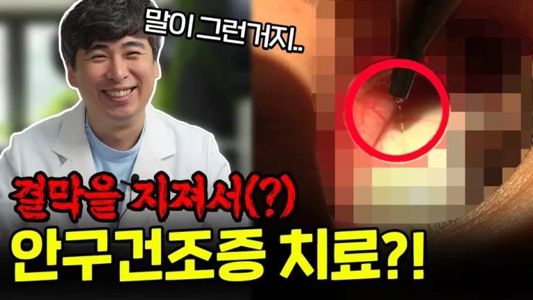 고주파 레이저로 안구건조증 치료 #결막이완증 #안구건조증치료