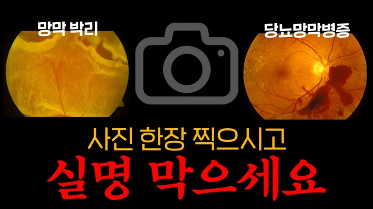 망막 사진 한 장 찍고 실명 예방하세요